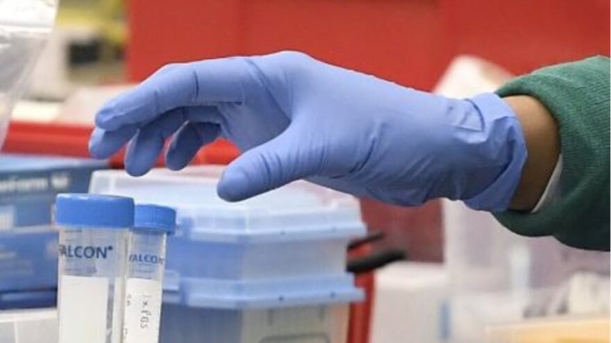 Κορωνοϊός: Γιατί είναι τόσο επικίνδυνος για την ανθρώπινη υγεία;