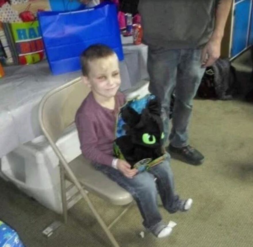 Γιαγιά έκοψε τα γεννητικά όργανα του εγγονού της επειδή έπαιζε με αυτά 