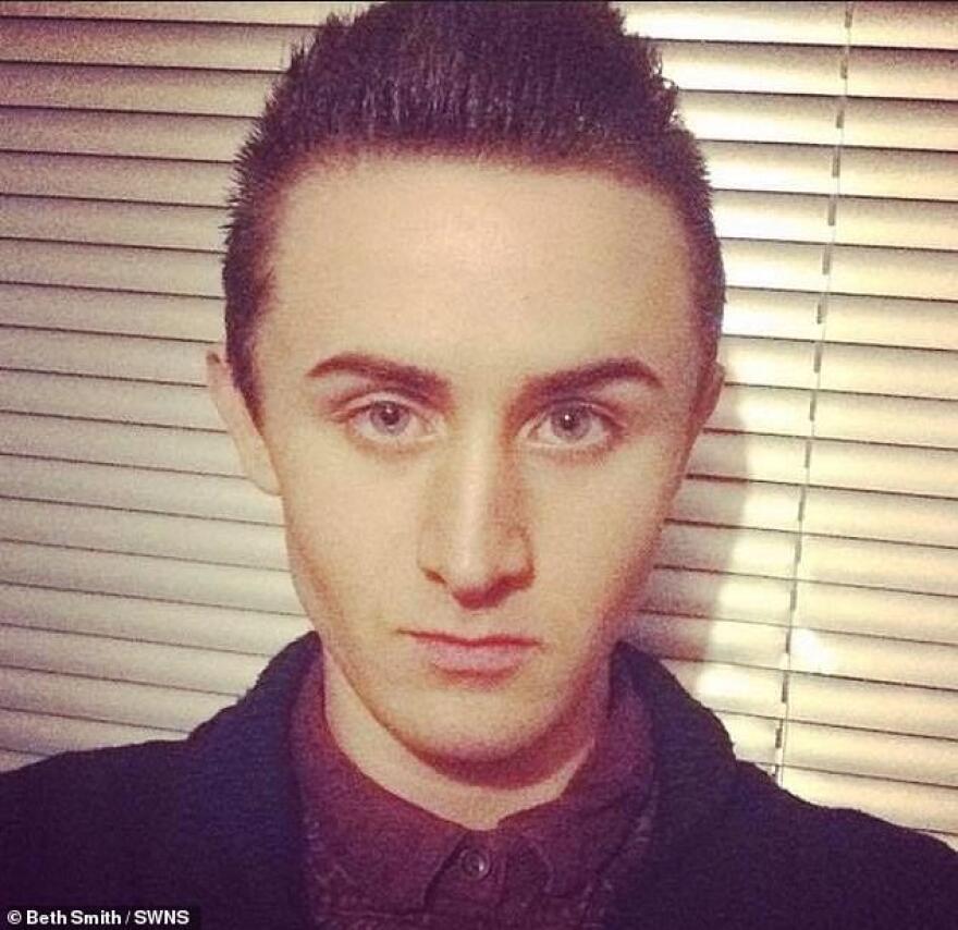 Vegan ξυλοκόπησε τη φίλη του με μπουκάλι ξύδι γιατί... μύριζε μπέικον!