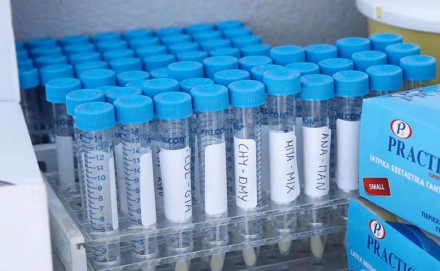 Κορωνοϊός: Τι είναι τα ορολογικά τεστ - Ποιες οι δυνατότητες και οι περιορισμοί τους