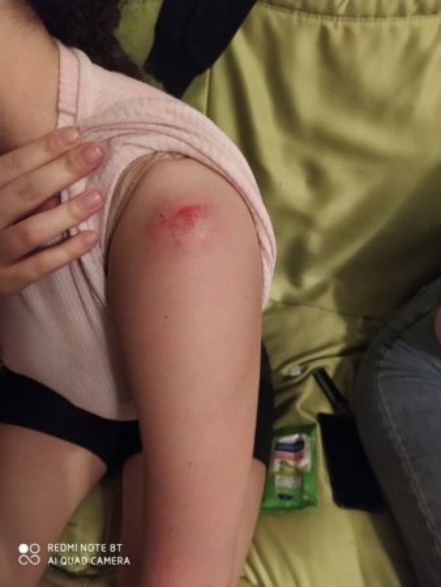 Θεσσαλονίκη: Επεισόδια με τα ΜΑΤ σε επιχείρηση εκκένωσης πλατείας