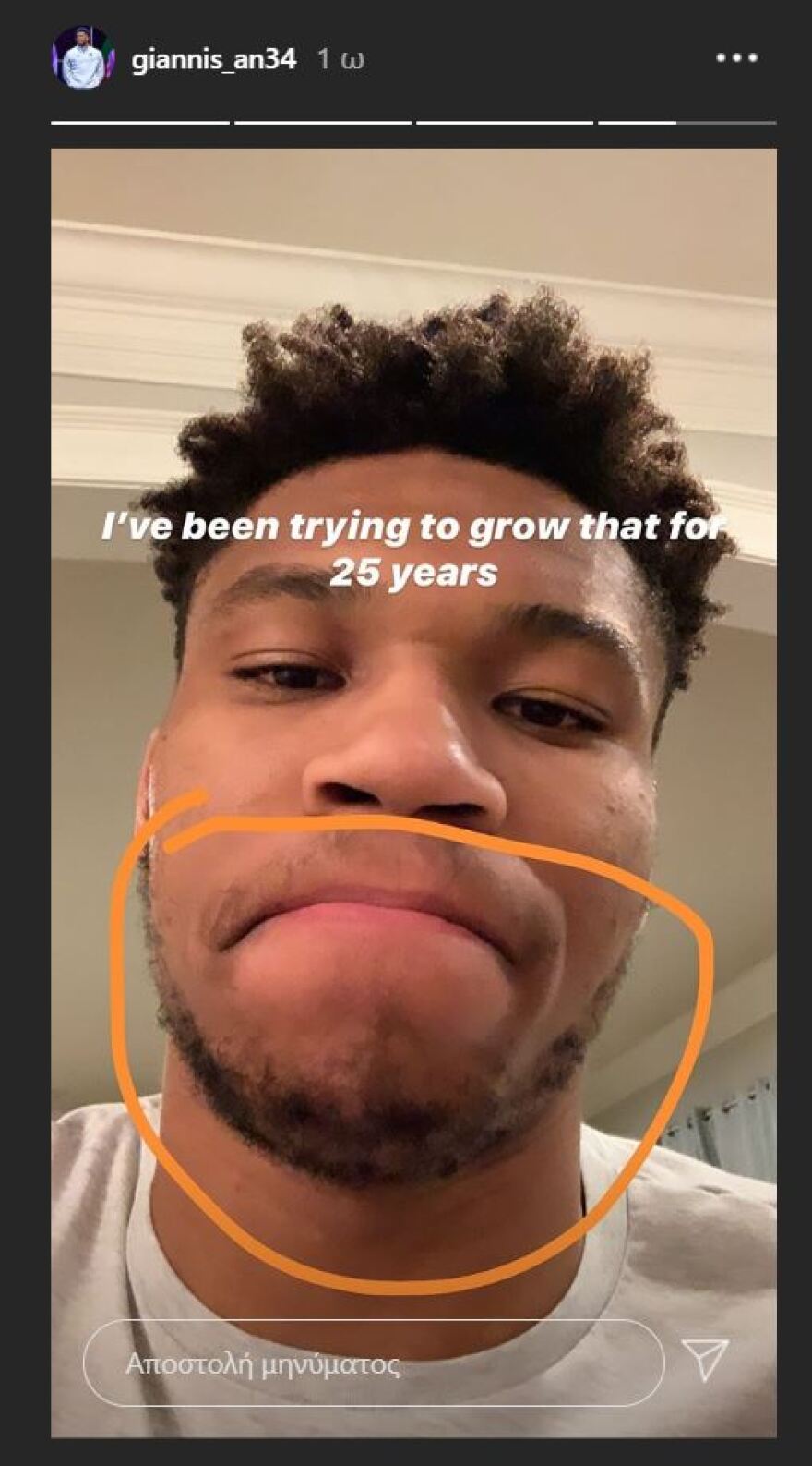 Αντετοκούνμπο: Ο απογοητευμένος Γιάννης προσπαθεί να αποκτήσει μούσι 25 χρόνια