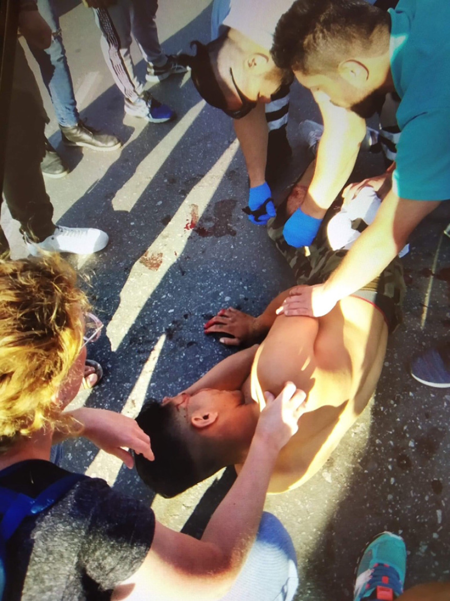 Άγριες συγκρούσεις μεταναστών στην Μυτιλήνη - Τραυματίστηκε νεαρός Αφγανός 