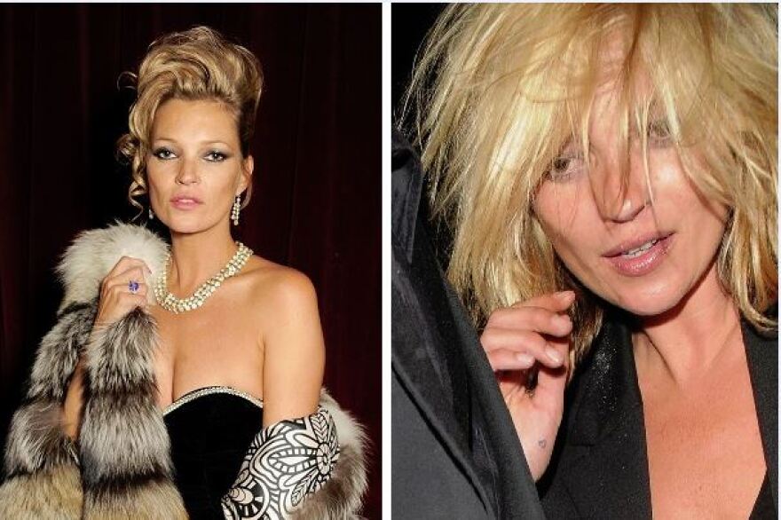 Κέιτ Μος: Όχι πια «κακό κορίτσι» - Δύο χρόνια χωρίς κραιπάλες