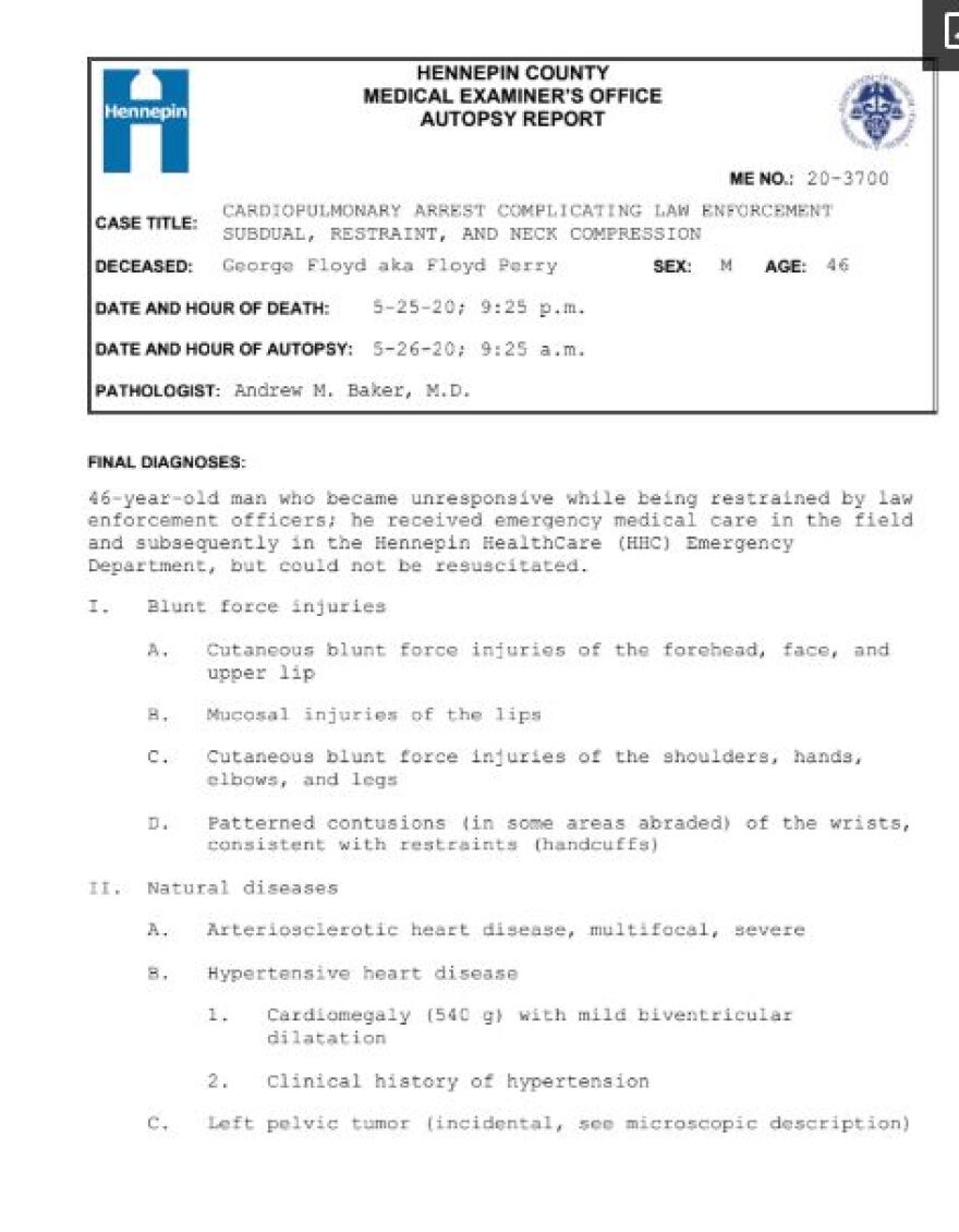 Τι έδειξε η ιατροδικαστική εξέταση του Φλόιντ: «Καρδιοαναπνευστική ανακοπή» η αιτία θανάτου - Θετικός στον κορωνοϊό