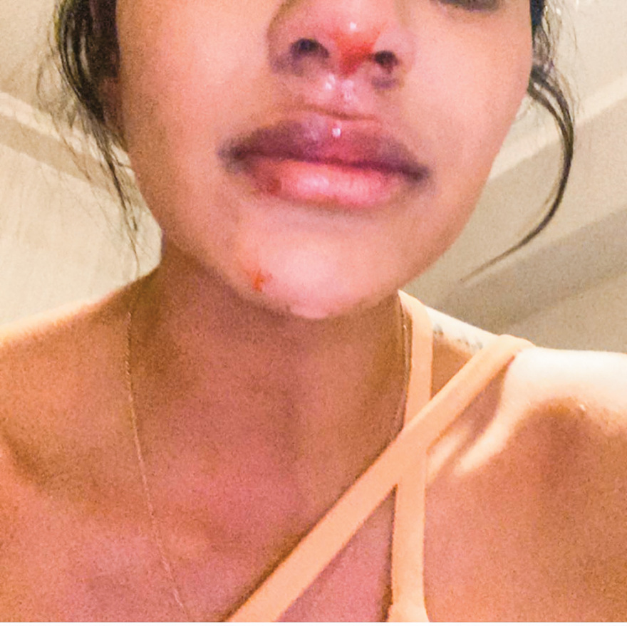 Δέρνουν και βιάζουν οι σταρ του αθλητισμού 