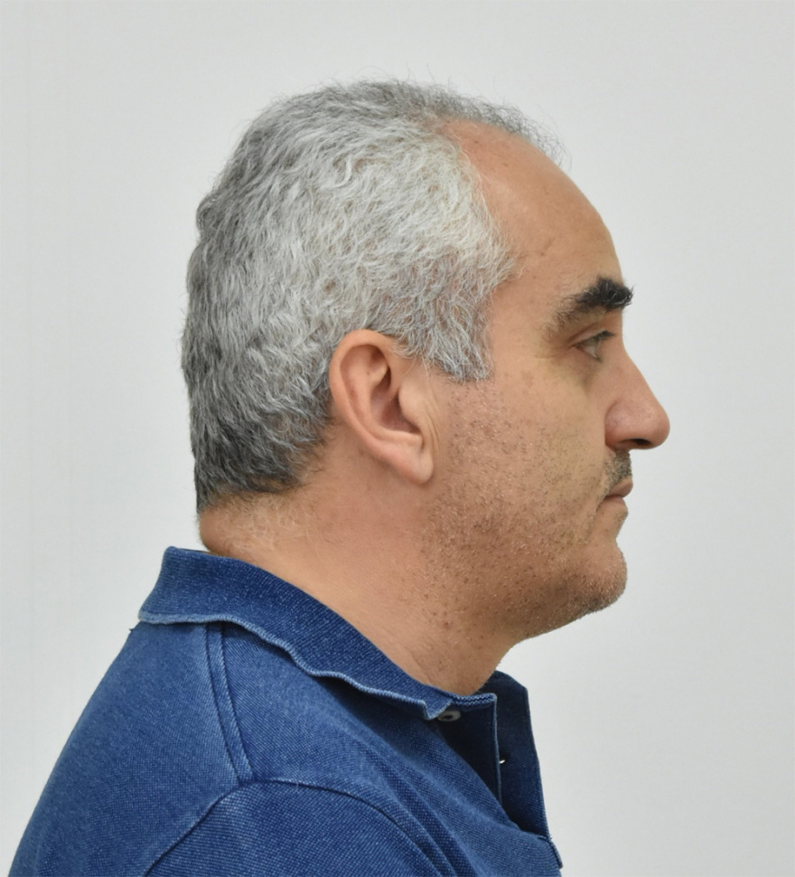 Αυτός είναι ο αδίστακτος ψευτογιατρός - Δείτε φωτογραφίες