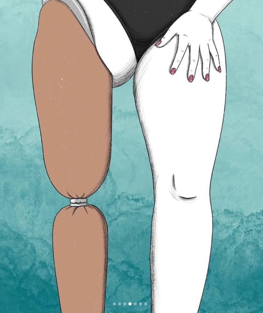 Marsha Elle: Η μαύρη Playmate με το πρόσθετο πόδι εμπνέει την τέχνη