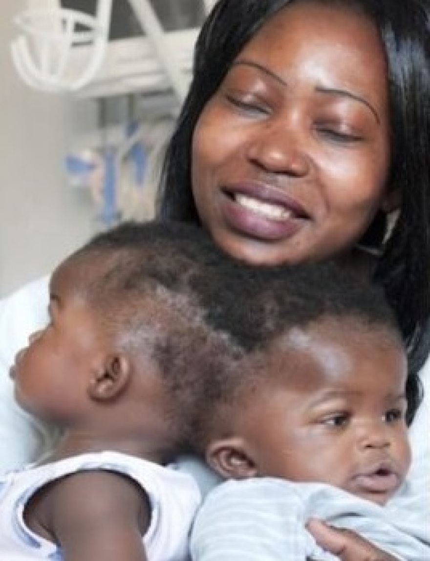 Ιταλία: Σιαμαία κοριτσάκια δυο ετών χωρίστηκαν με επιτυχία σε νοσοκομείο της Ρώμης