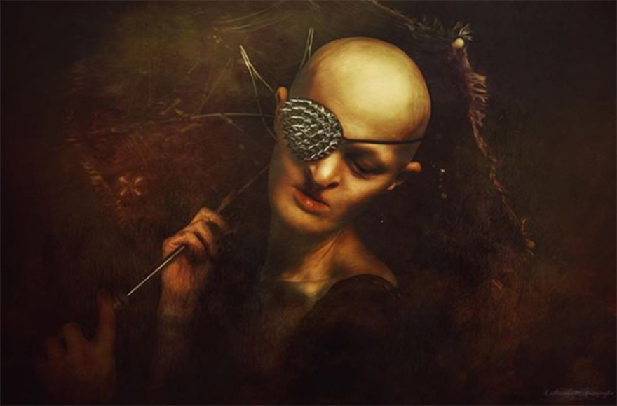 Μέλανι Γκέιντος: Το «τέρας» με τη σπάνια νόσο που έγινε τοπ μόντελ