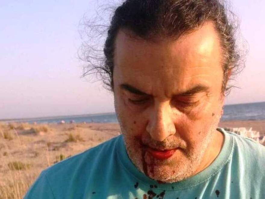 Αχαΐα: Επίθεση σε βάρος δυο οικολόγων στο Πάρκο Στροφυλιάς