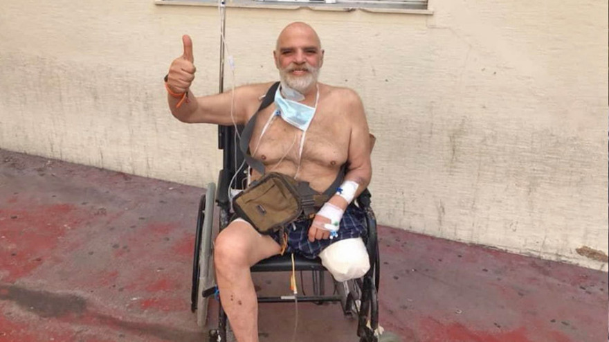 Γιώργος Βούρος: Το μήνυμα του ηθοποιού μετά τον ακρωτηριασμό του ποδιού του