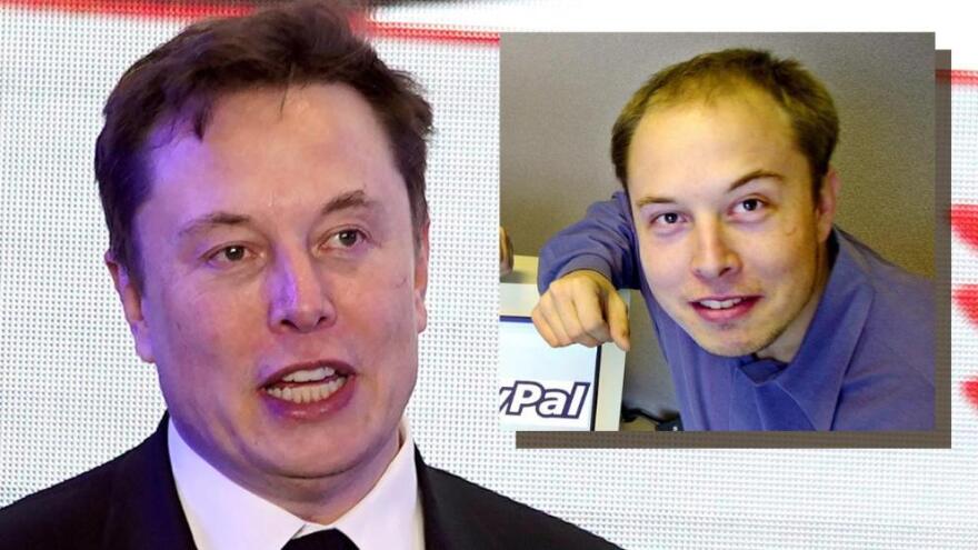 Έλον Μασκ: Ο CEO της Tesla ουδέποτε παραδέχθηκε ότι έχει κάνει μεταμόσχευση μαλλιών 