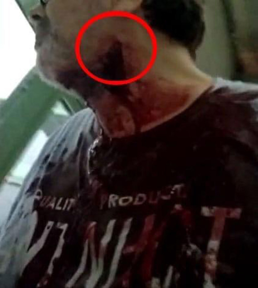 Στέφανος Χίος: Ο δράστης της επίθεσης ήθελε να τον σκοτώσει