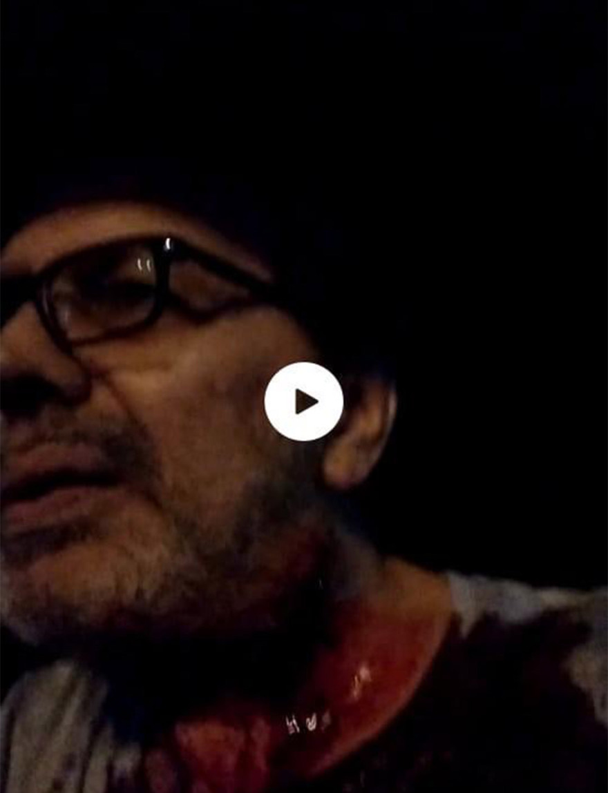 Στέφανος Χίος: Ο δράστης της επίθεσης ήθελε να τον σκοτώσει