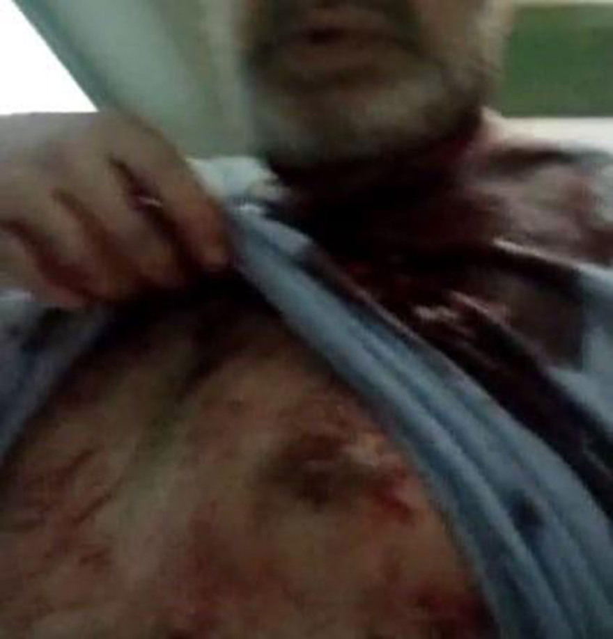 Στέφανος Χίος: Ο δράστης της επίθεσης ήθελε να τον σκοτώσει