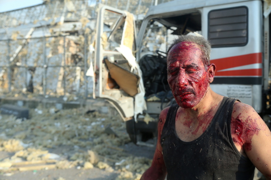 Έκρηξη στη Βηρυτό: Η καταστροφή και ο ανθρώπινος θρήνος - Σκληρές εικόνες