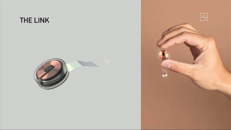 Έλον Μασκ: Παρουσίασε εμφύτευμα εγκεφάλου - Θα ελέγχει κινητά και υπολογιστές με τη σκέψη