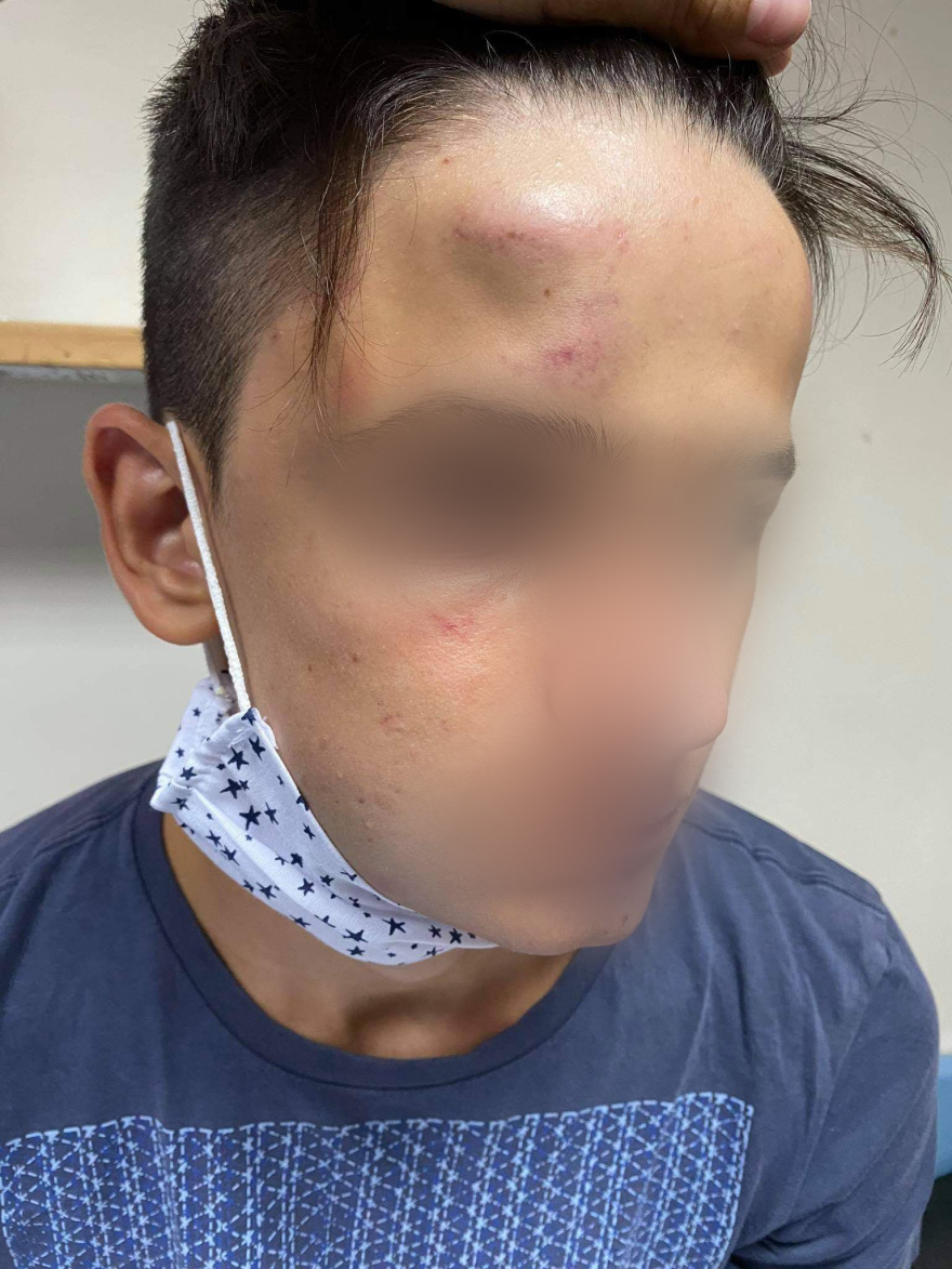 Ξυλοδαρμός 17χρονου στο Γαλάτσι: «Τον χτυπούσαν στο κεφάλι για δέκα λεπτά»