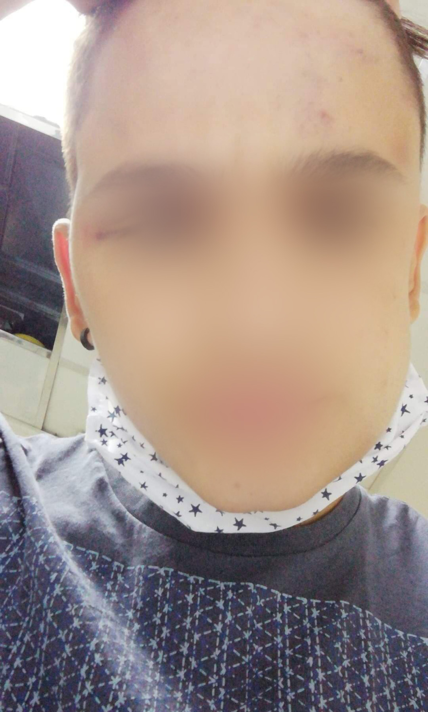 Ξυλοδαρμός 17χρονου στο Γαλάτσι: «Τον χτυπούσαν στο κεφάλι για δέκα λεπτά»