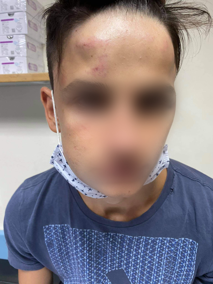 Ξυλοδαρμός 17χρονου στο Γαλάτσι: «Τον χτυπούσαν στο κεφάλι για δέκα λεπτά»