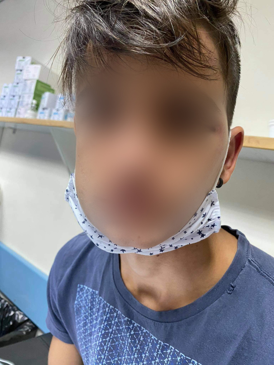 Ξυλοδαρμός 17χρονου στο Γαλάτσι: «Τον χτυπούσαν στο κεφάλι για δέκα λεπτά»