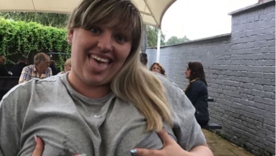 Ντέμπι Χόρτον: Το ασήκωτο στήθος της την καθήλωσε σε αναπηρική καρέκλα