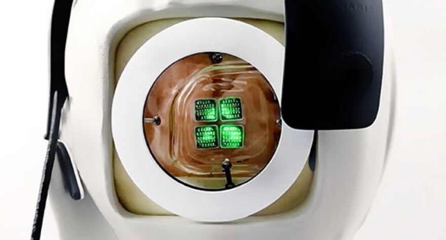 Έρευνα-σταθμός: Βιονικό μάτι μπορεί να γιατρέψει την τύφλωση