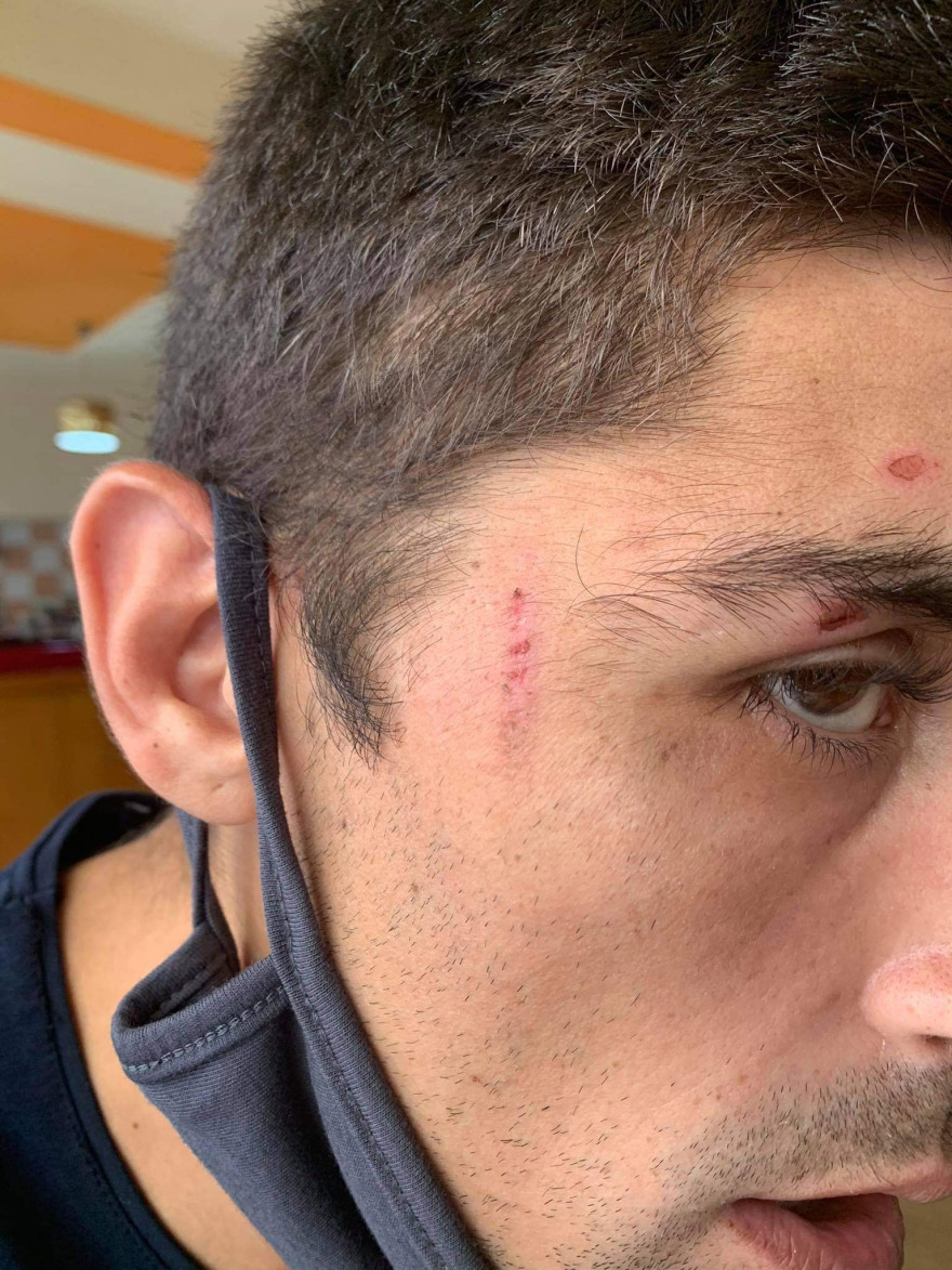 Καταγγελία για ξυλοδαρμό κρατουμένων από αστυνομικούς στην Κοζάνη - «Μας φέρθηκαν σαν ζώα»