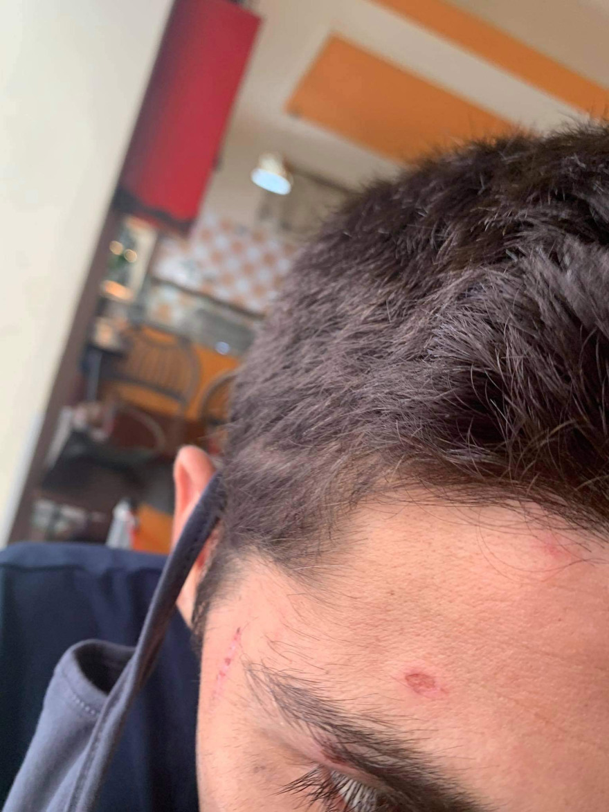 Καταγγελία για ξυλοδαρμό κρατουμένων από αστυνομικούς στην Κοζάνη - «Μας φέρθηκαν σαν ζώα»