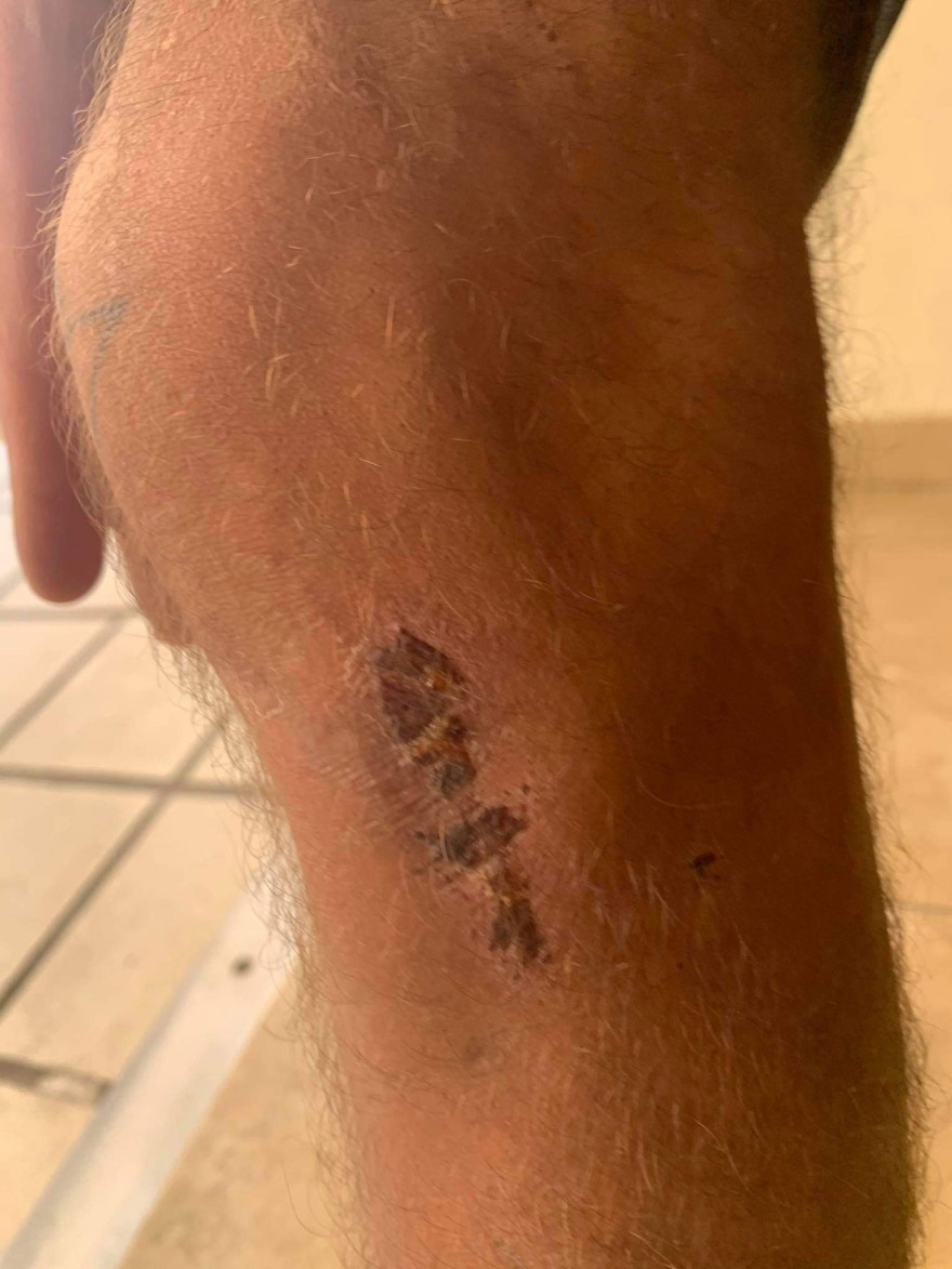 Καταγγελία για ξυλοδαρμό κρατουμένων από αστυνομικούς στην Κοζάνη - «Μας φέρθηκαν σαν ζώα»