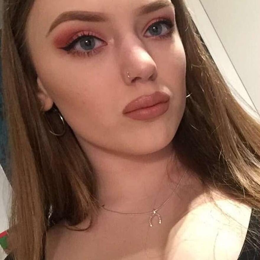 «Το τεράστιο στήθος μού καταστρέφει τη ζωή» λέει 20χρονη Βρετανή και απευθύνει έκκληση για βοήθεια