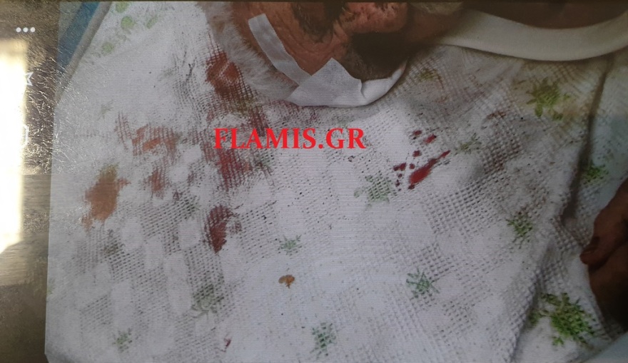 Θρασύτατη ληστεία στην Πάτρα: Άγριο ξύλο σε ηλικιωμένο για να του πάρουν μερικά ευρώ! (φωτογραφίες)