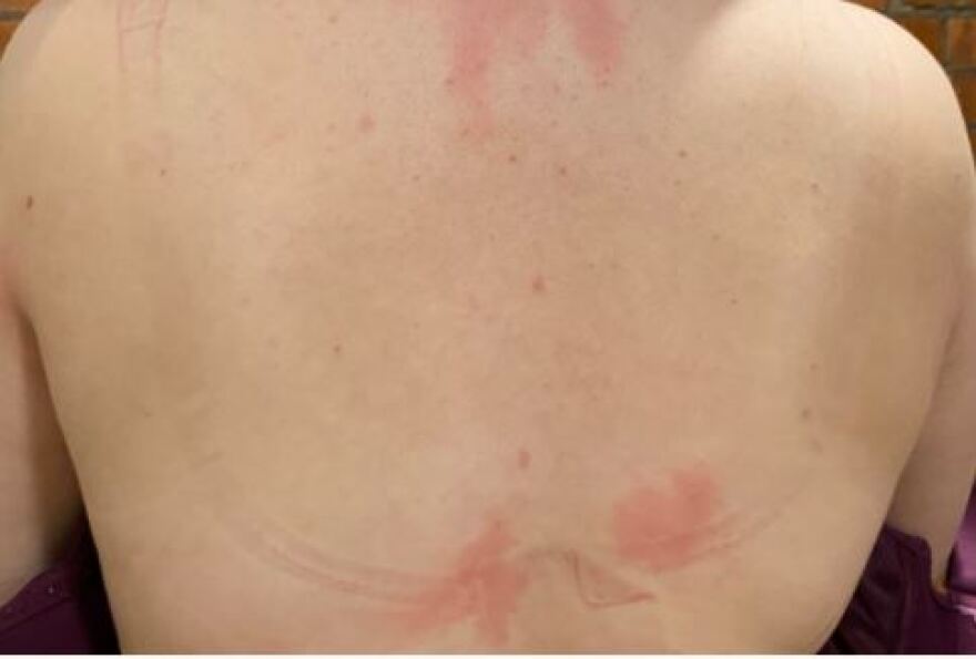 «Το τεράστιο στήθος μού καταστρέφει τη ζωή» λέει 20χρονη Βρετανή και απευθύνει έκκληση για βοήθεια