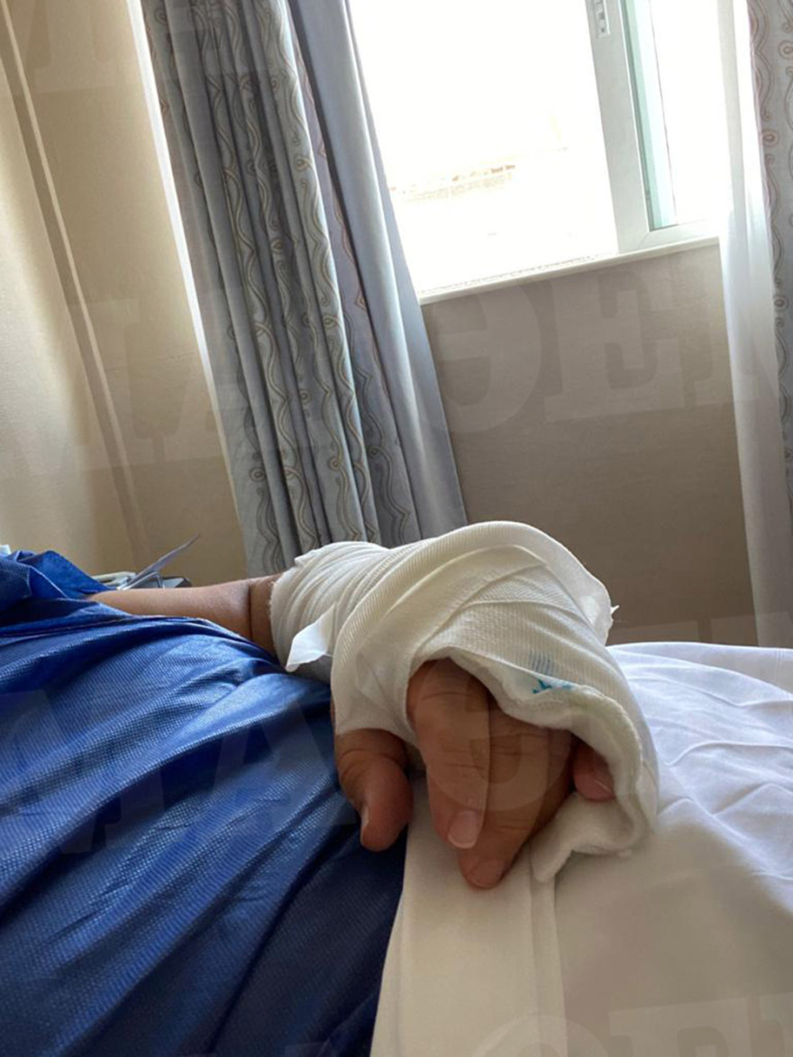 Μύκονος: Τι αποκαλύπτει ο μεσίτης που ξυλοκοπήθηκε για την επίθεση και τους δράστες