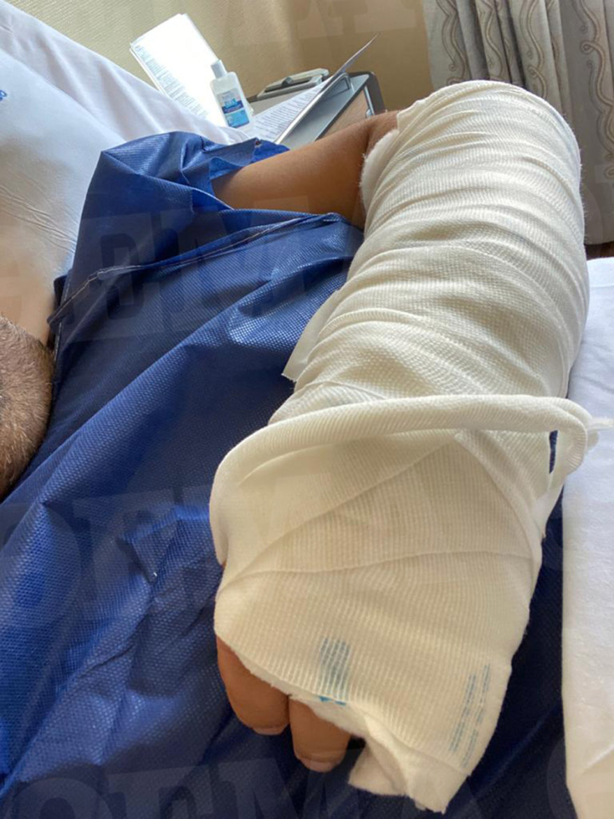 Μύκονος: Τι αποκαλύπτει ο μεσίτης που ξυλοκοπήθηκε για την επίθεση και τους δράστες