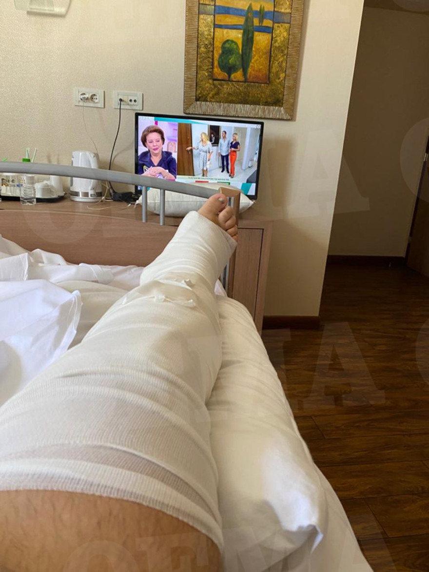 Μύκονος: Τι αποκαλύπτει ο μεσίτης που ξυλοκοπήθηκε για την επίθεση και τους δράστες