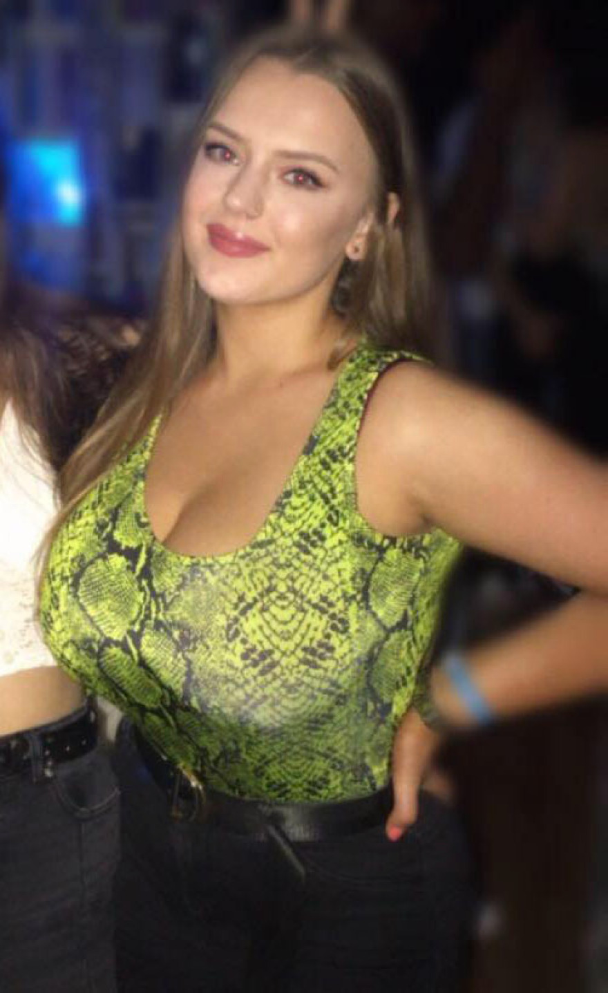 «To πελώριο στήθος κάνει τη ζωή μας κόλαση» - Χυμώδεις Βρετανίδες «ξεσπούν» στη Sun