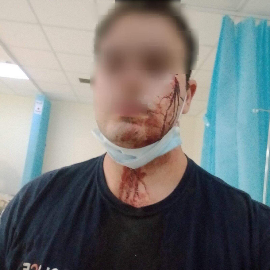 Μενίδι: Αστυνομικοί δέχθηκαν επίθεση από Ρομά όταν τους έλεγξαν για συνωστισμό