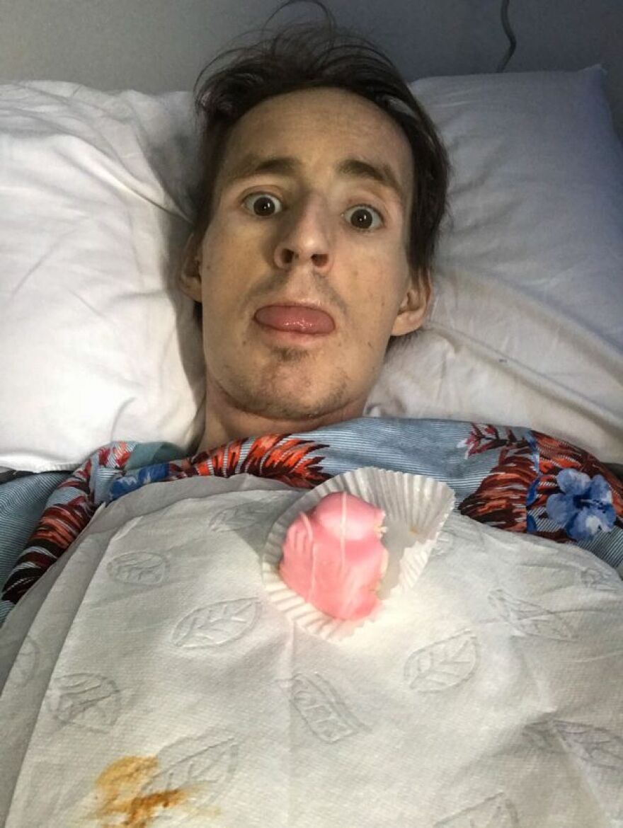 Στέλεχος της Google έσπασε το χέρι του και... ανακάλυψε ότι πάσχει από καρκίνο