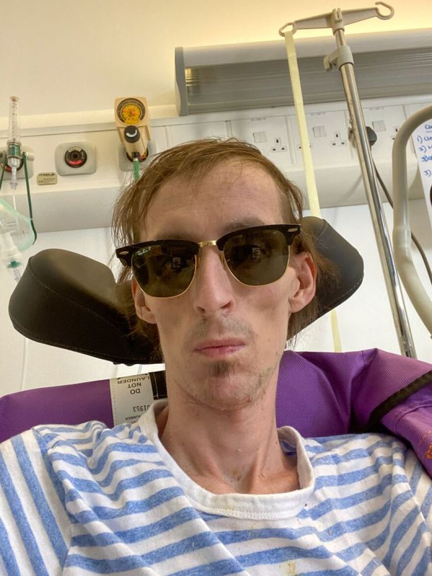 Στέλεχος της Google έσπασε το χέρι του και... ανακάλυψε ότι πάσχει από καρκίνο