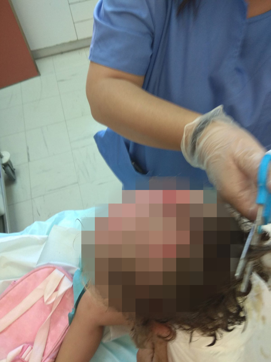 Κορινθία - Συγκλονίζει η μητέρα της 3χρονης: «Πάλεψα με τα ροτβάιλερ για να σώσω την κόρη μου από τα δόντια τους»