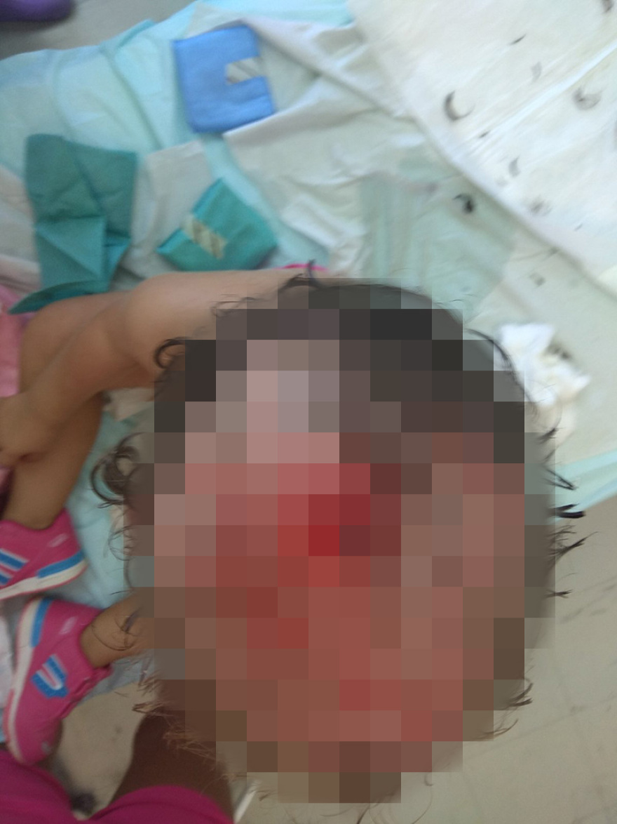 Κορινθία - Συγκλονίζει η μητέρα της 3χρονης: «Πάλεψα με τα ροτβάιλερ για να σώσω την κόρη μου από τα δόντια τους»