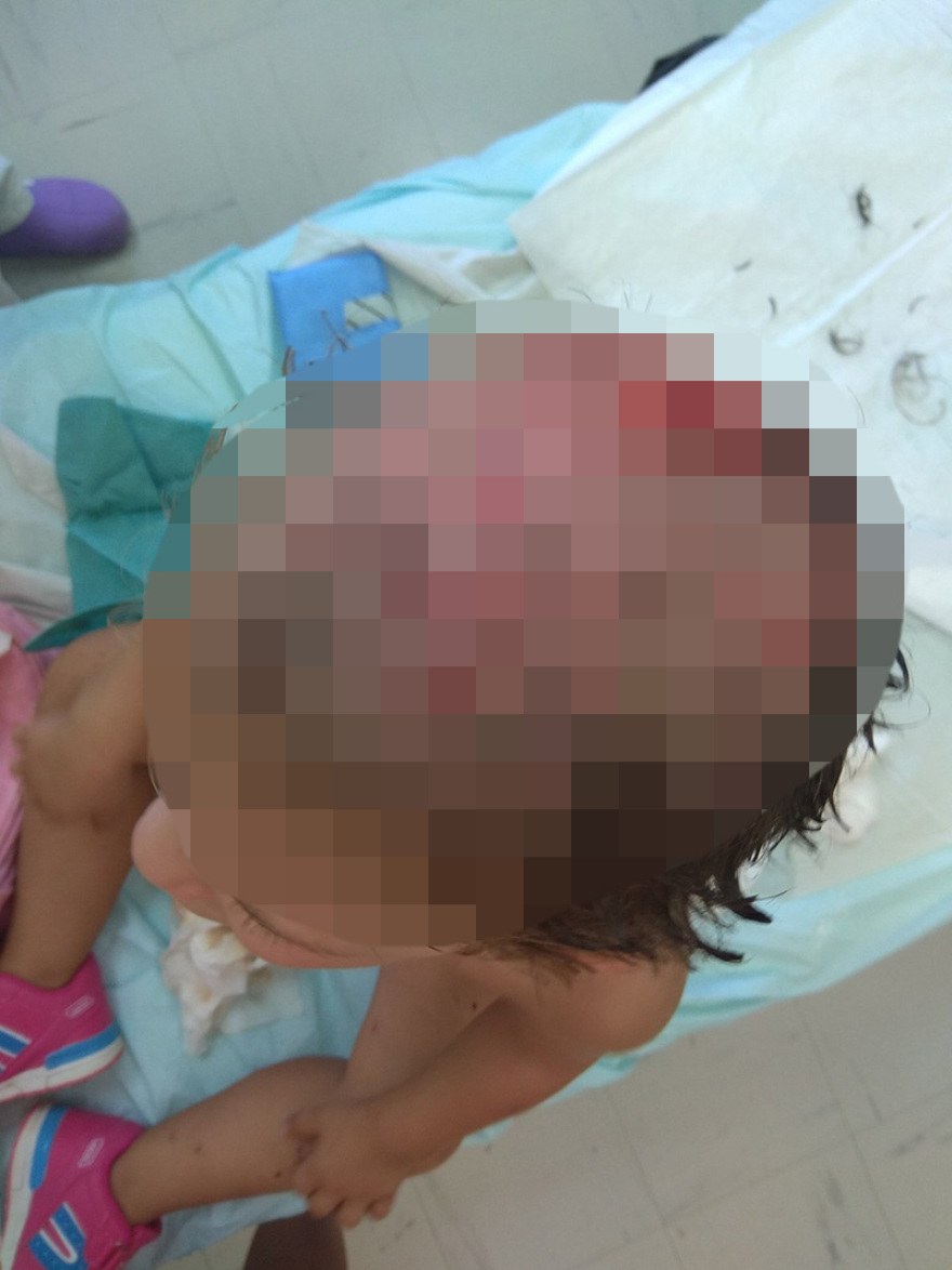 Κορινθία - Συγκλονίζει η μητέρα της 3χρονης: «Πάλεψα με τα ροτβάιλερ για να σώσω την κόρη μου από τα δόντια τους»