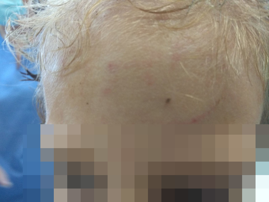 Κορινθία - Συγκλονίζει η μητέρα της 3χρονης: «Πάλεψα με τα ροτβάιλερ για να σώσω την κόρη μου από τα δόντια τους»