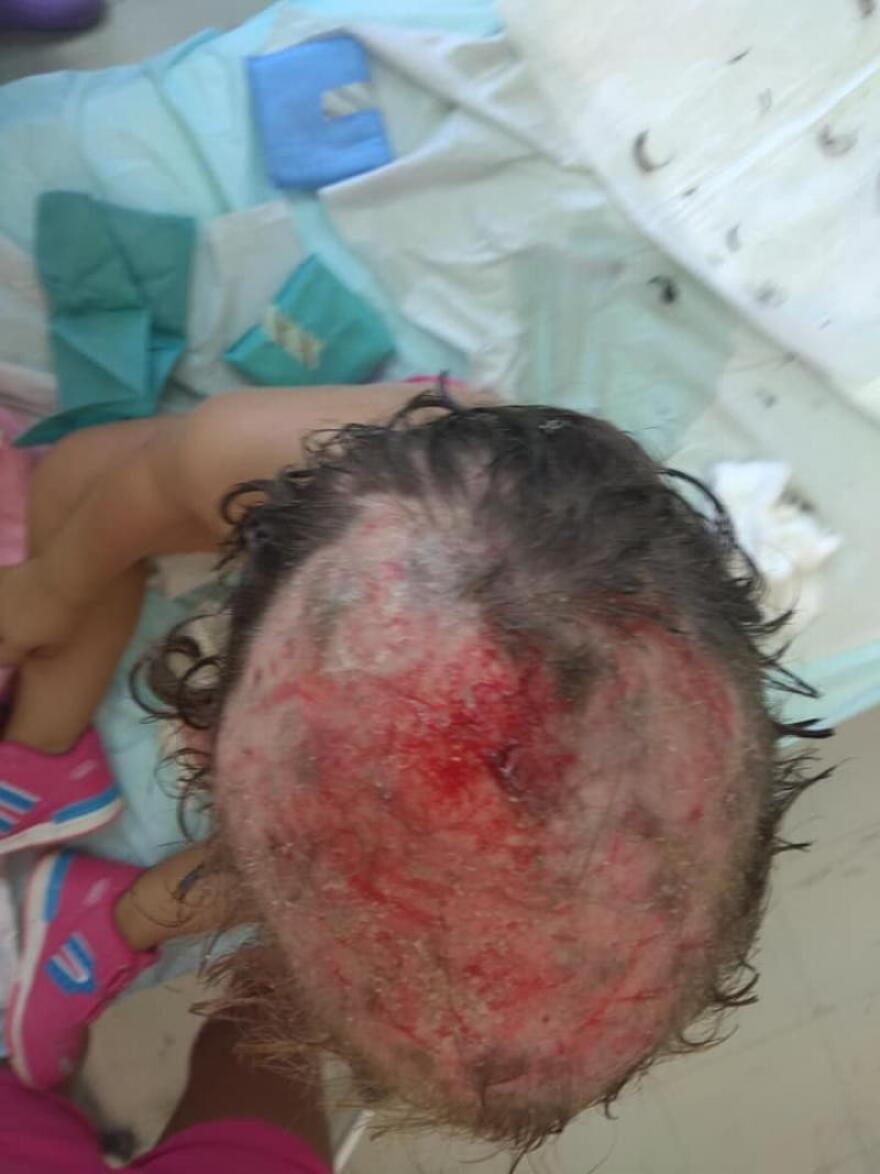 Άγρια επίθεση σκύλων σε κοριτσάκι στην Κορινθία: Έκκληση της μάνας να βρεθεί ο ιδιοκτήτης τους