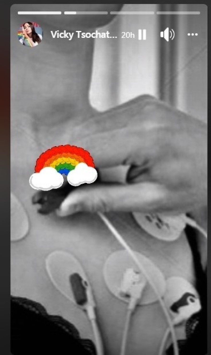 Βίκυ Σταμάτη: Στο νοσοκομείο με συμπτώματα εμφράγματος