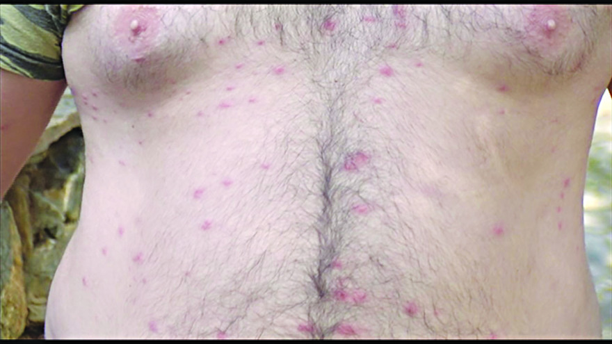 Κρήτη: Ένα ολόκληρο χωριό... έπαθε αλλεργία - Τι συνέβη