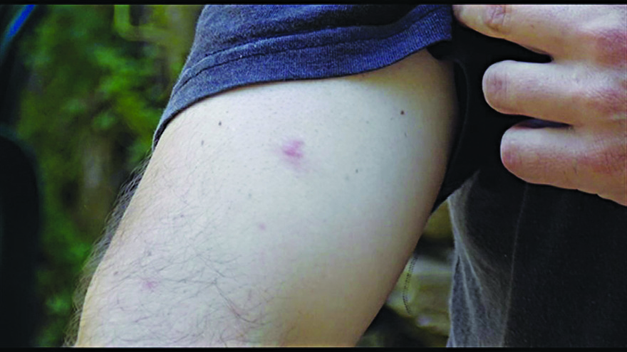 Κρήτη: Ένα ολόκληρο χωριό... έπαθε αλλεργία - Τι συνέβη