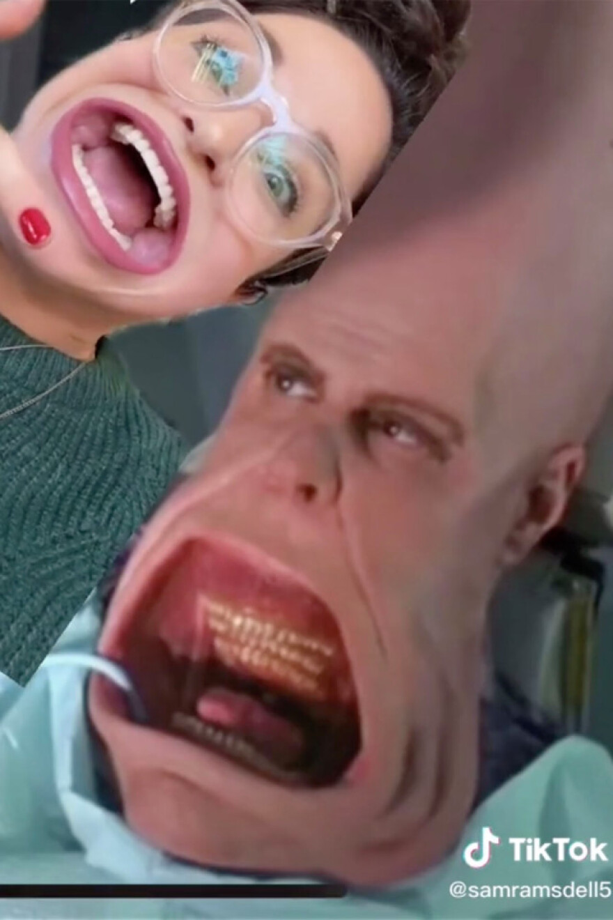 To τεράστιο στόμα της την έκανε διάσημη στο TikTok - Δείτε βίντεο 